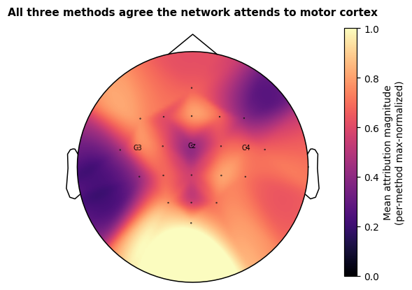 All three methods agree the network attends to motor cortex
