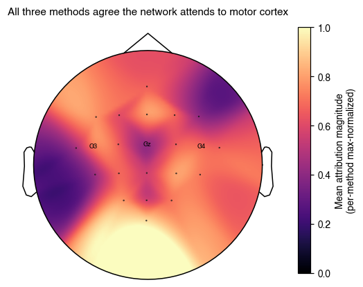 All three methods agree the network attends to motor cortex